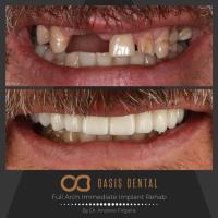 Oasis Dental Studio - Chirn Park image 3